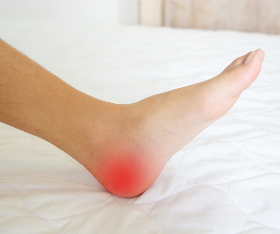 Heel pain